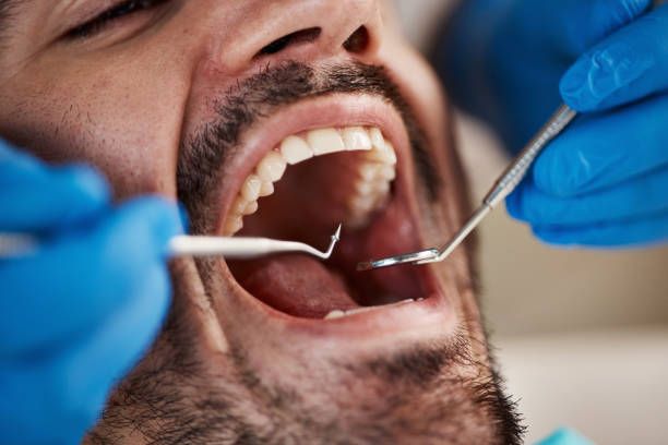 Best Emergency Treatment for Dental Infections or Abscesses in Evergreen, CO