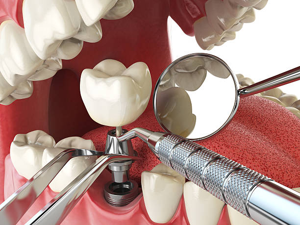 Best Cosmetic Emergency Dentistry in Evergreen, CO